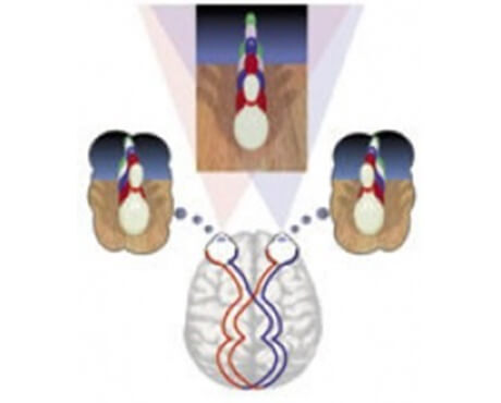 Stroke Visual Expansion Field